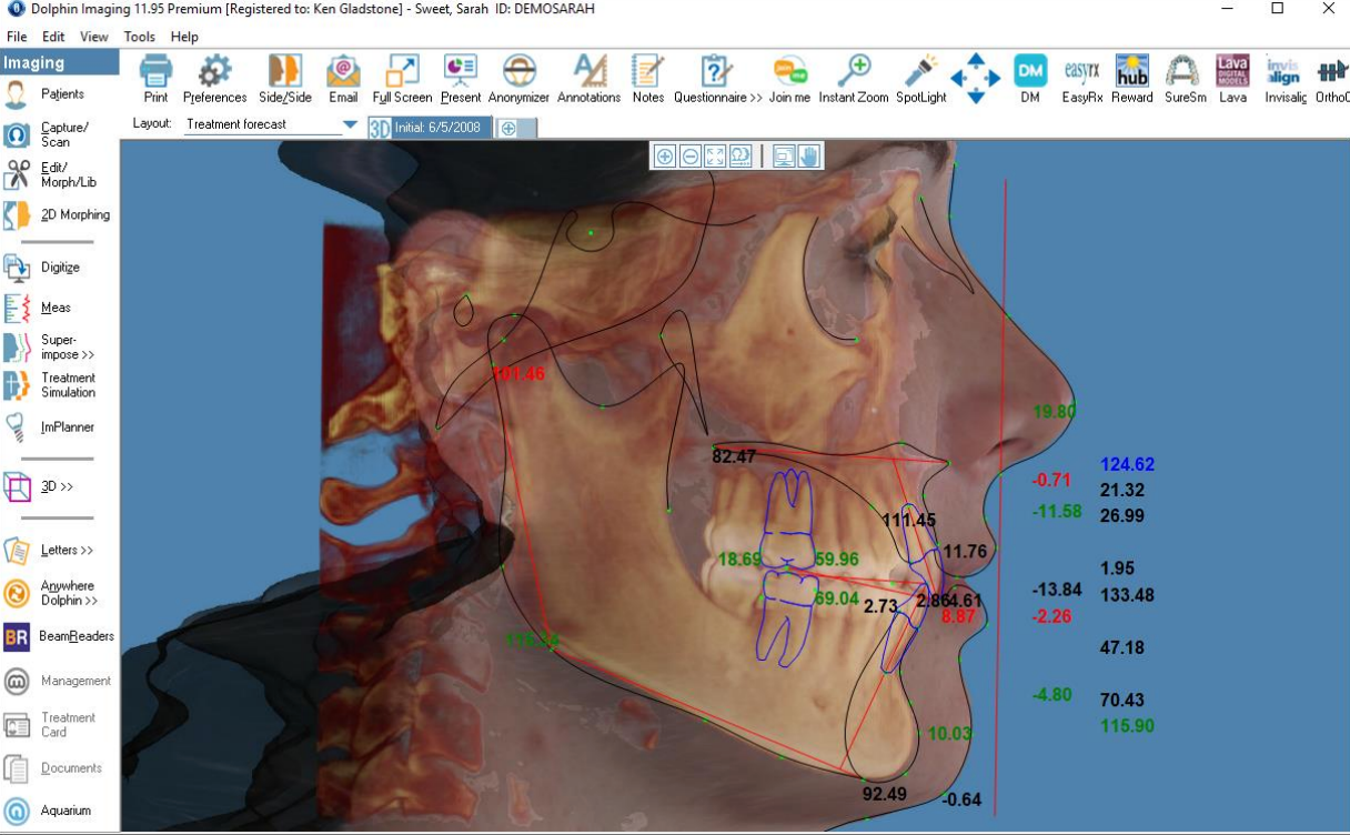 Dolphin Imaging 3D & 3D Surgery SOLO