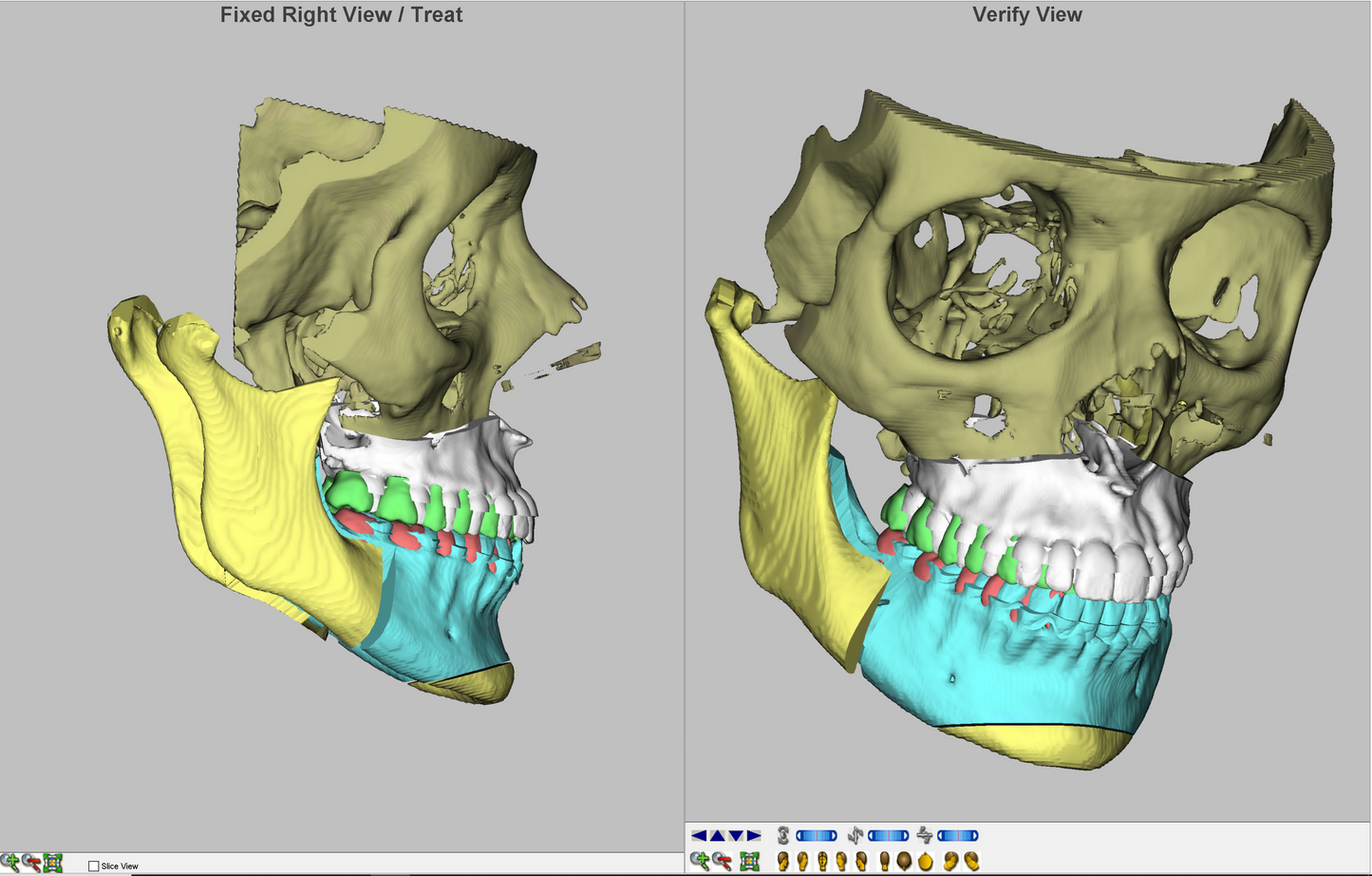 Dolphin Imaging 3D Surgery