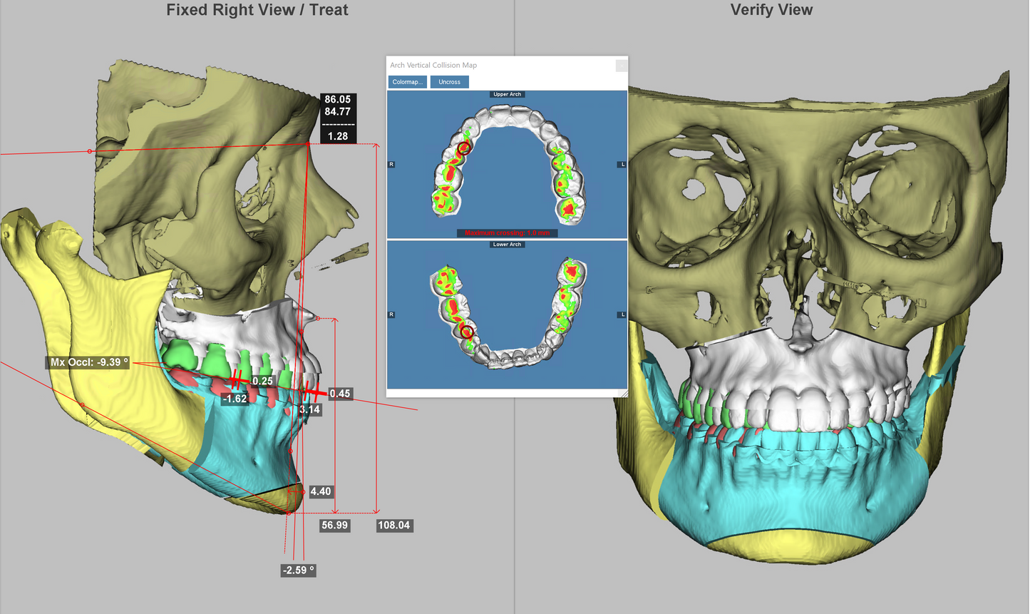 Dolphin Imaging 3D & 3D Surgery + RENEW