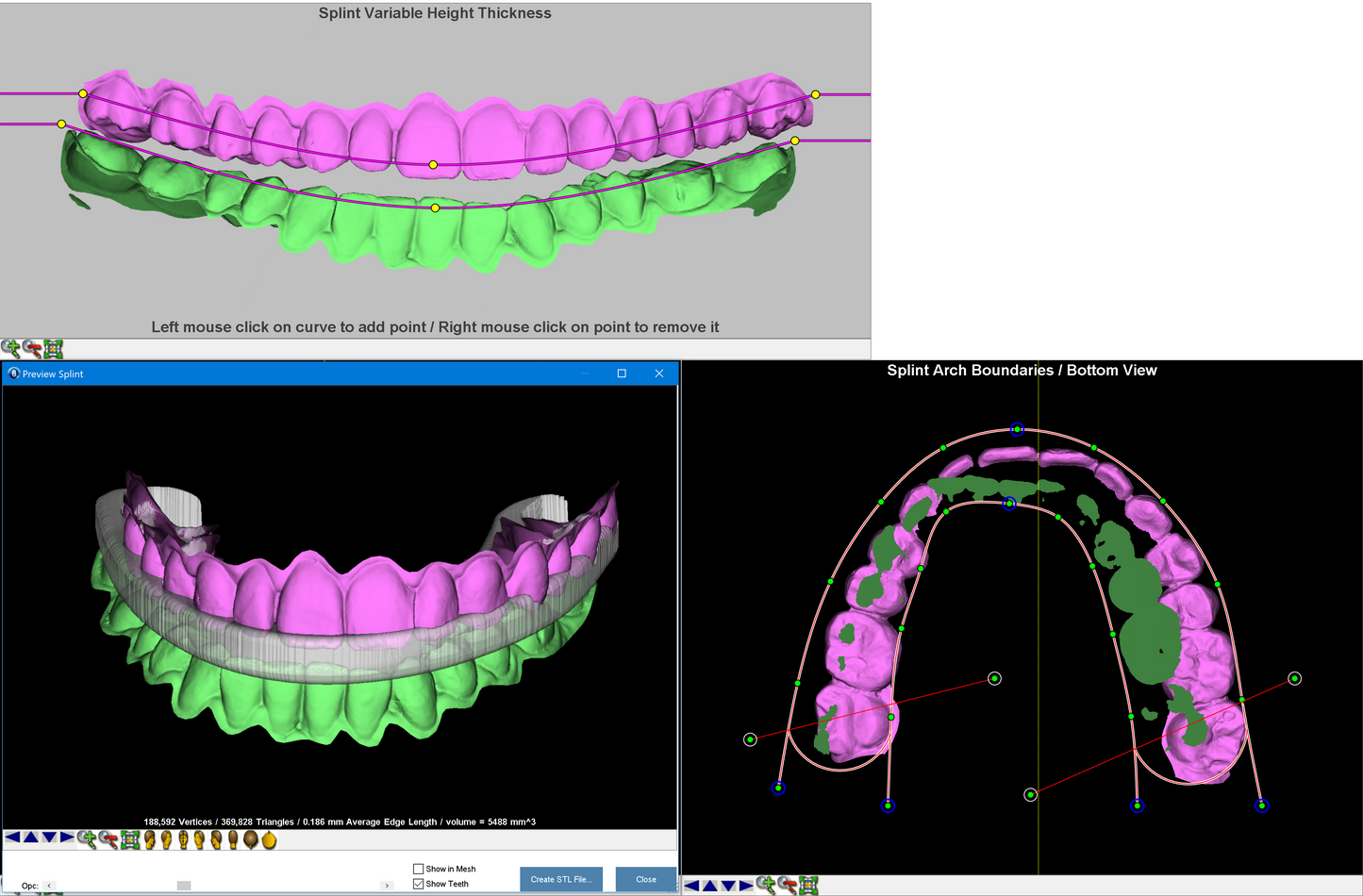 Dolphin Imaging 3D & 3D Surgery SOLO