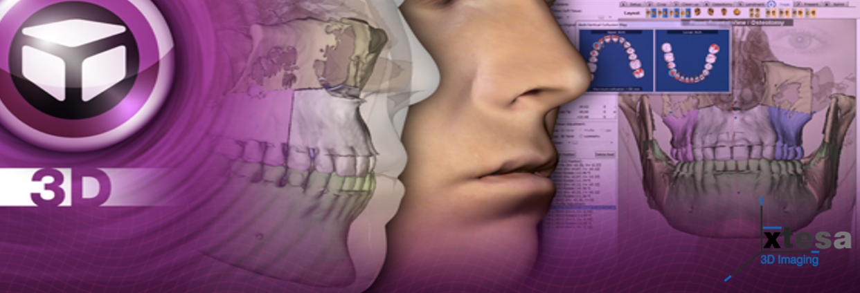 Dolphin Imaging 3D & 3D Surgery SOLO