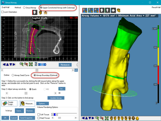 Dolphin Imaging 12 UPGRADRE  3D + 3D Surgery + Aquarium