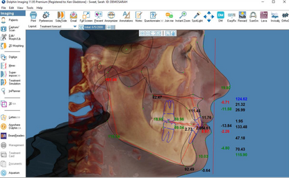 Dolphin Imaging  3D & 3D Surgery SOLO