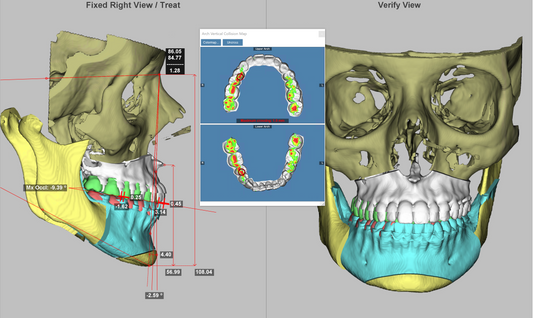 Dolphin Imaging 3D Surgery