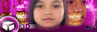 Dolphin Advance Imaging  3D and 3D Surgery