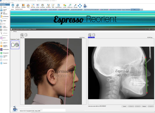 Espresso Tools - ReOrient & Overlay