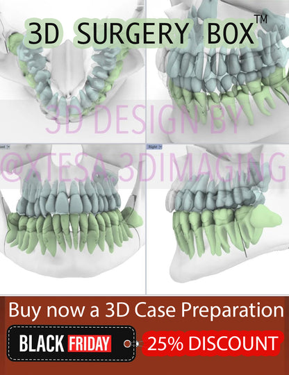 3D Case Preparation