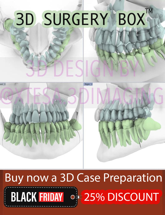 3D Case Preparation