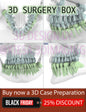 3D Case Preparation